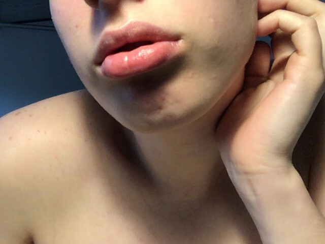  online foto 1